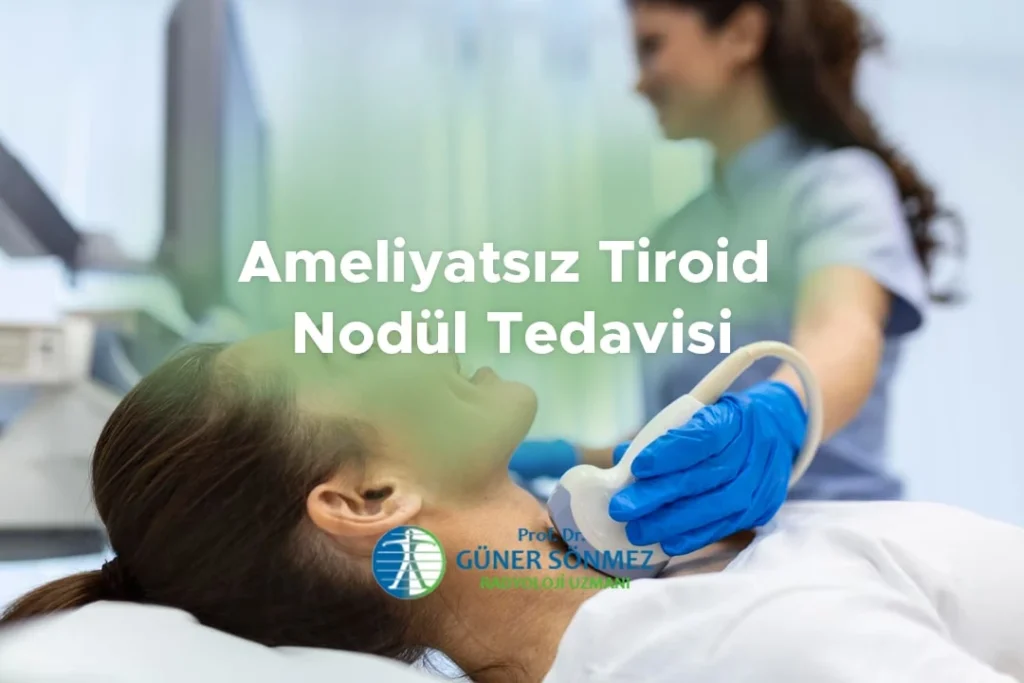 Ameliyatsız Tiroid Nodül Tedavisi