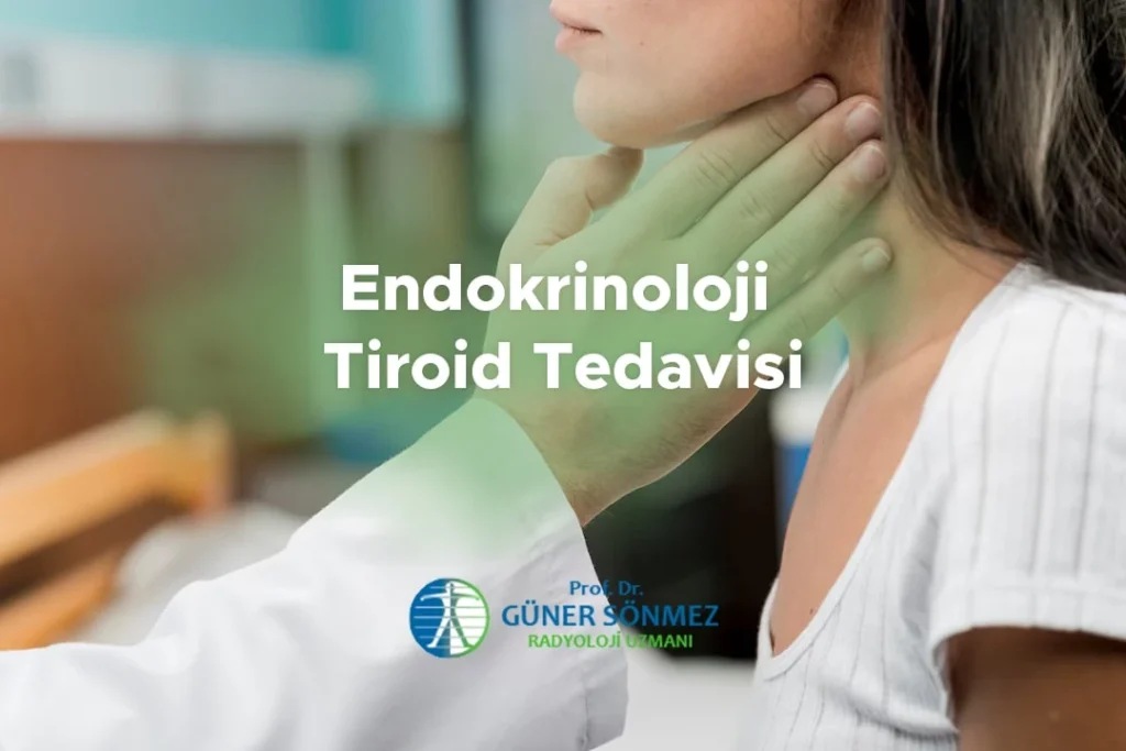 Endokrinoloji Tiroid Tedavisi