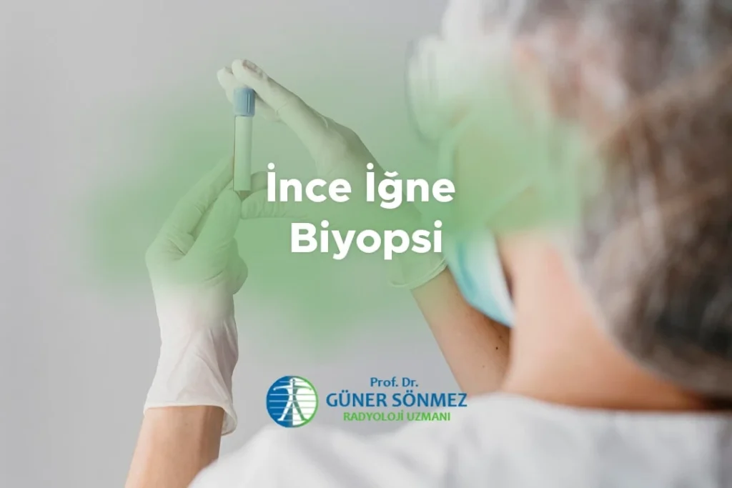 İnce İğne Biyopsi