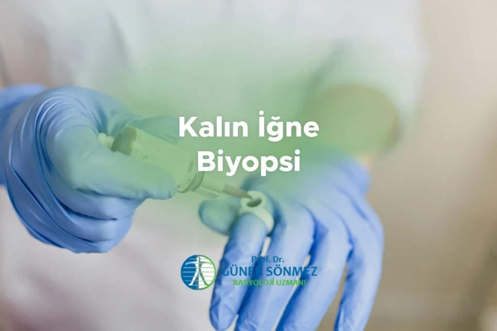 Kalın İğne Biyopsi