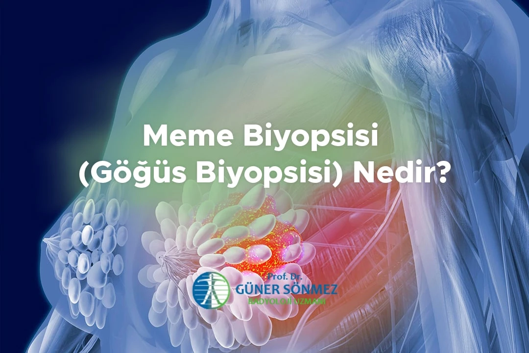 Meme Biyopsisi (Göğüs Biyopsisi) Nedir