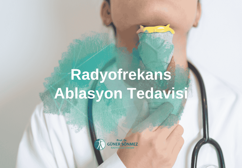 Radyofrekans Ablasyon Tedavisi