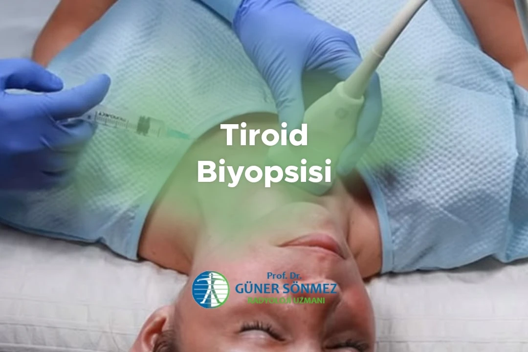 Tiroid Biyopsisi