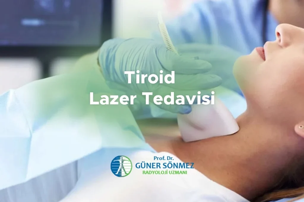 Tiroid Lazer Tedavisi