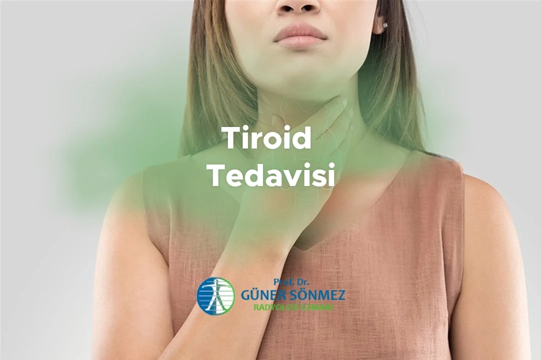 Tiroid Tedavisi