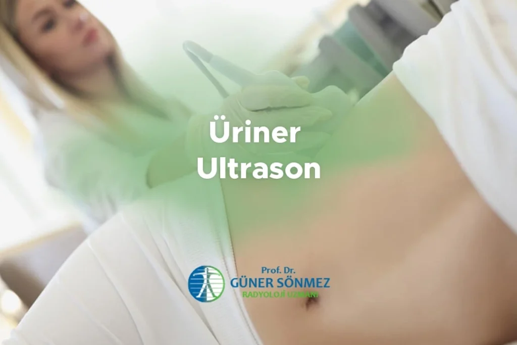 Üriner Ultrason