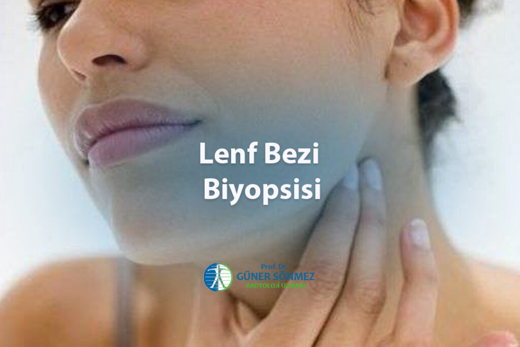 Lenf Bezi Biyopsisi