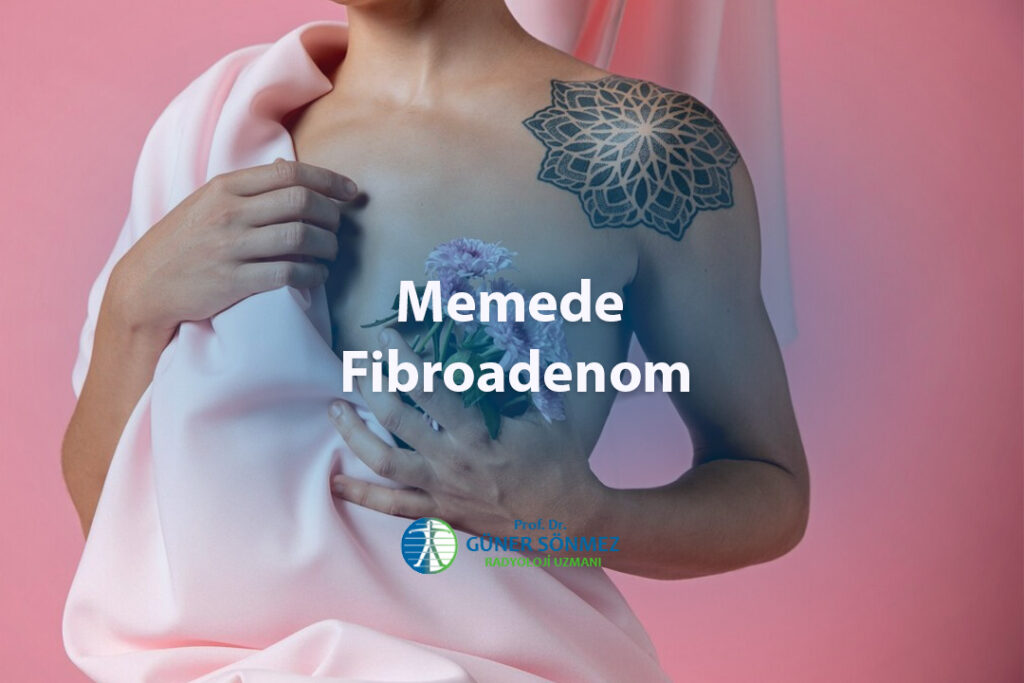 Memede Fibroadenom