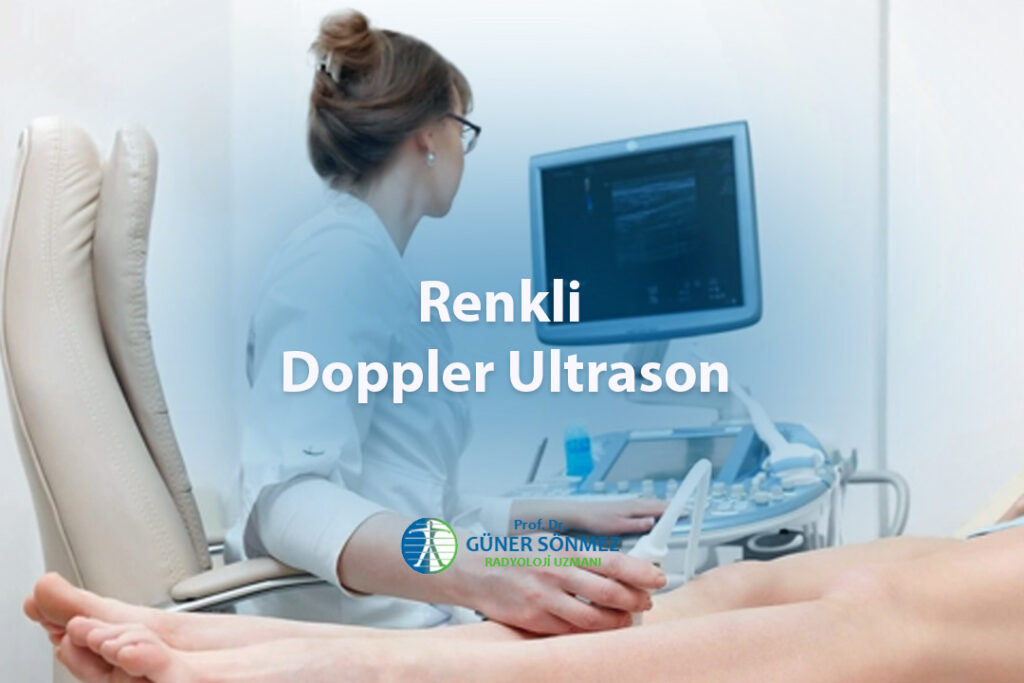 Renkli Doppler Ultrason