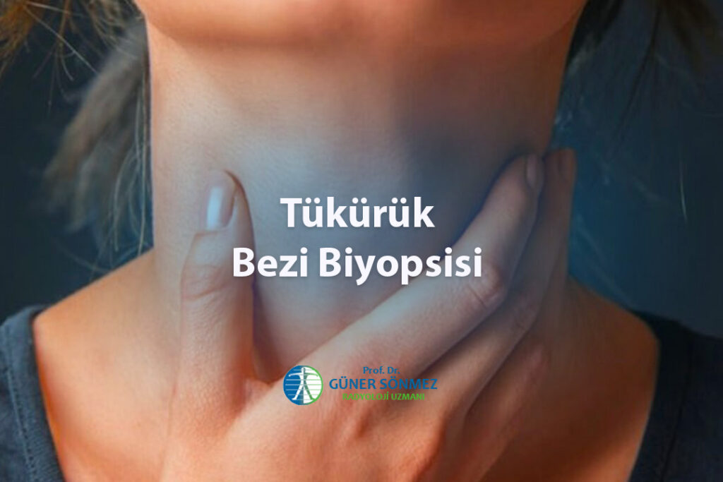 Tükürük Bezi Biyopsisi