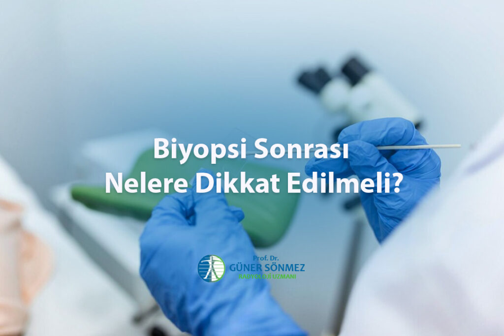 Biyopsi Sonrası Nelere Dikkat Edilmeli