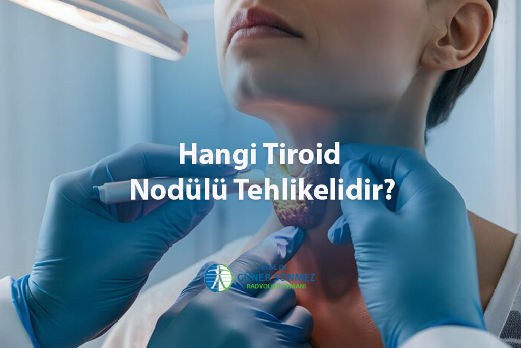 Hangi Tiroid Nodülü Tehlikelidir