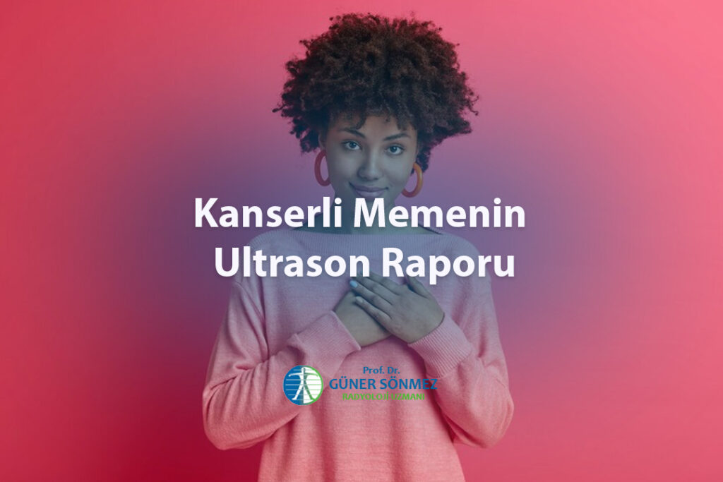 Kanserli Memenin Ultrason Raporu