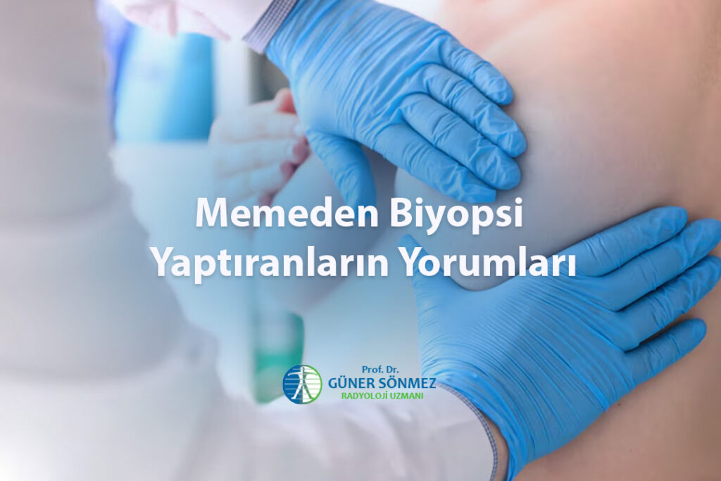 Memeden Biyopsi Yaptıranların Yorumları