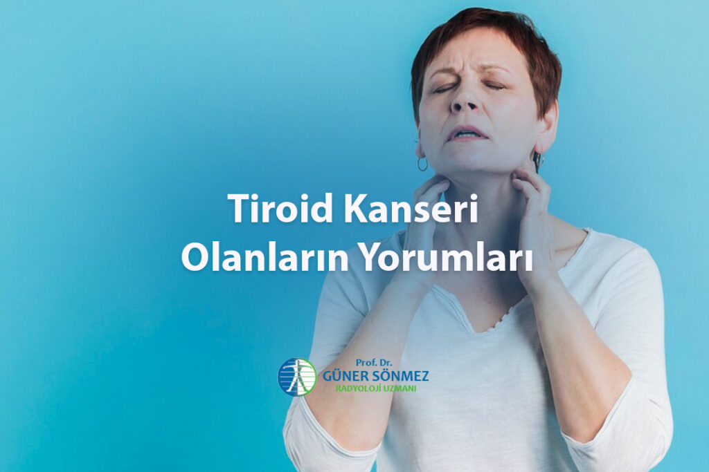 Tiroid Kanseri Olanların Yorumları