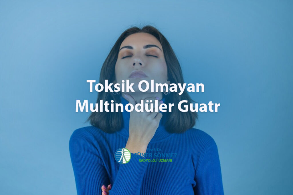 Toksik Olmayan Multinodüler Guatr