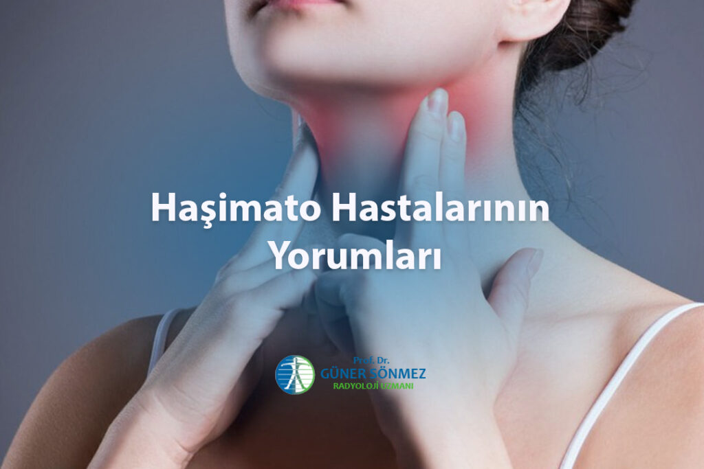 Haşimato Hastalarının Yorumları