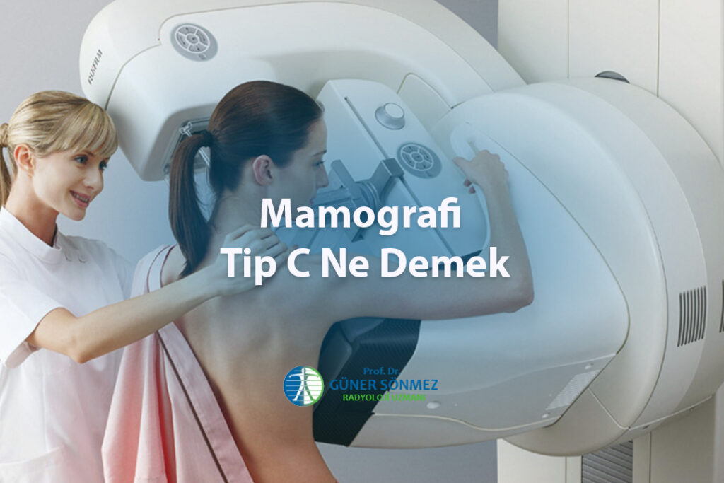 Mamografi Tip C Ne Demek