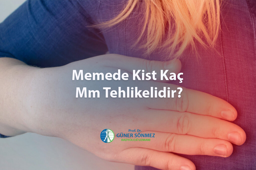 Memede Kist Kaç Mm Tehlikelidir