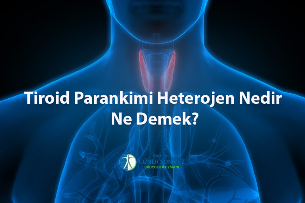 Tiroid Parankimi Heterojen Nedir Ne Demek
