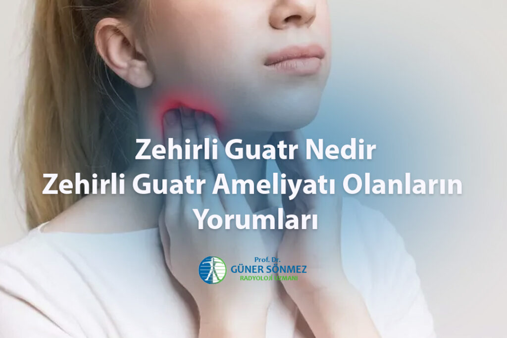 Zehirli Guatr Nedir Zehirli Guatr Ameliyatı Olanların Yorumları