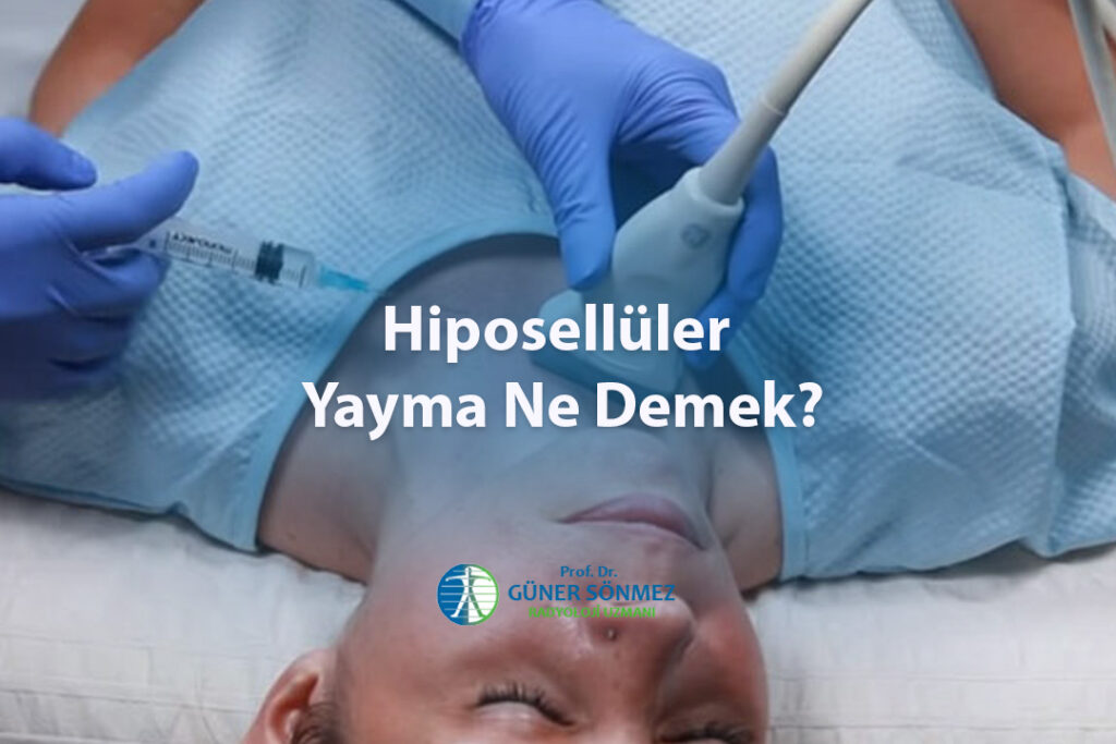 Hiposellüler Yayma Ne Demek
