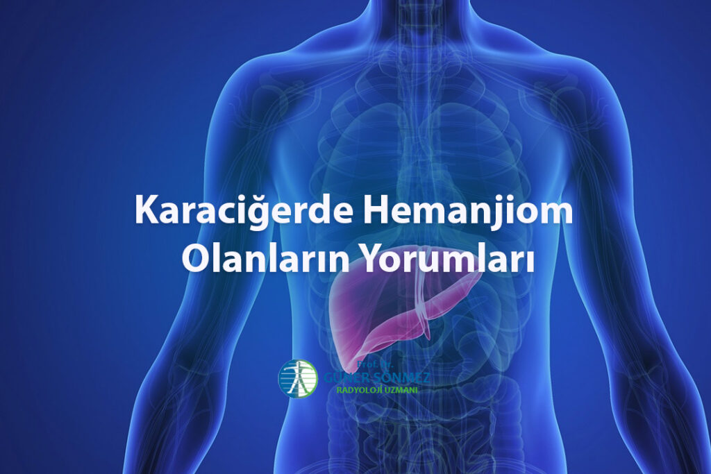 Karaciğerde Hemanjiom Olanların Yorumları