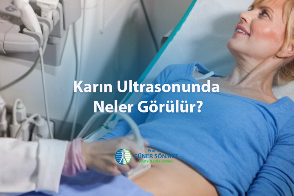 Karın Ultrasonunda Neler Görülür