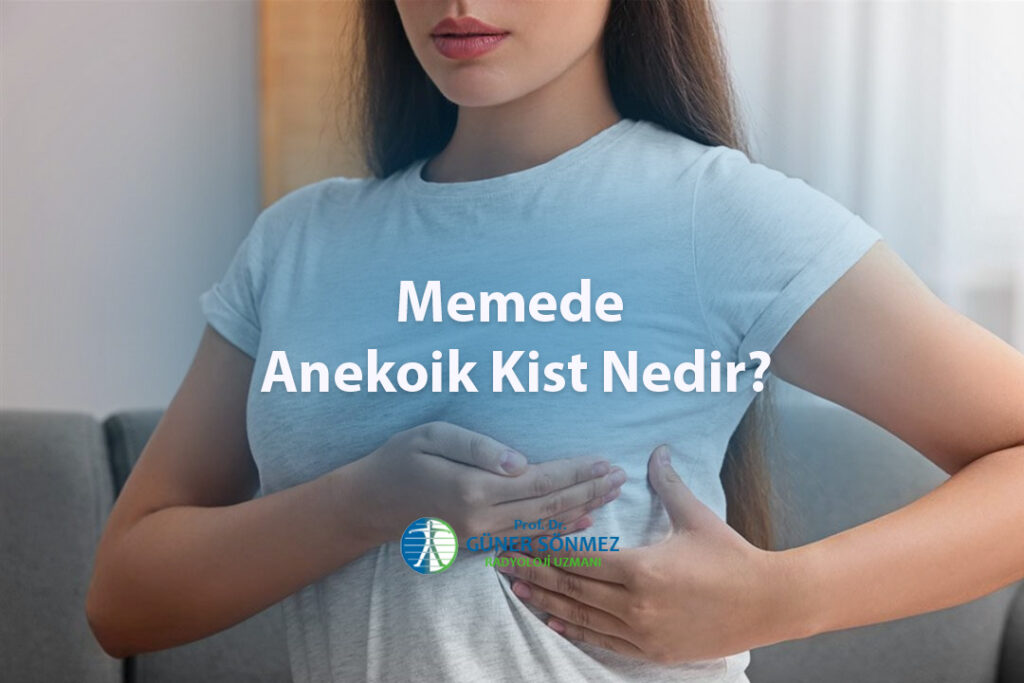Memede Anekoik Kist Nedir