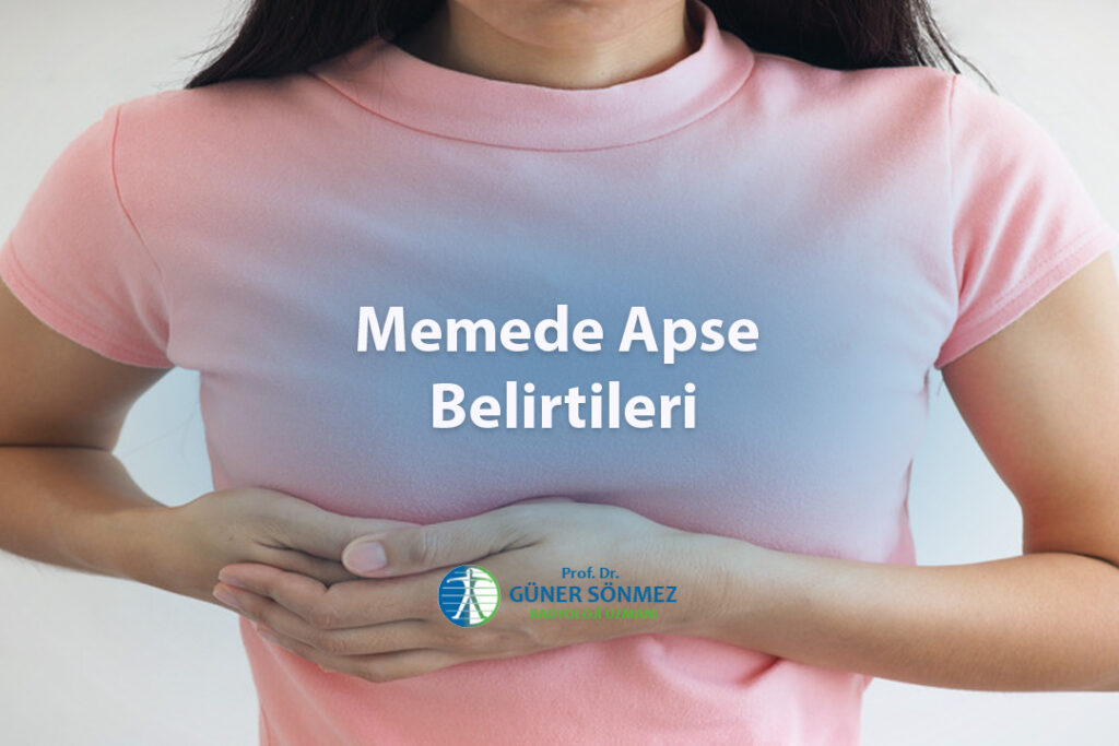 Memede Apse Belirtileri