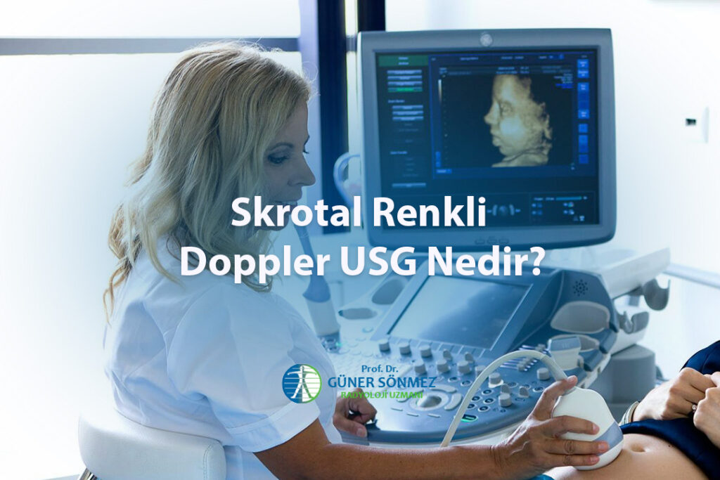 Skrotal Renkli Doppler USG Nedir