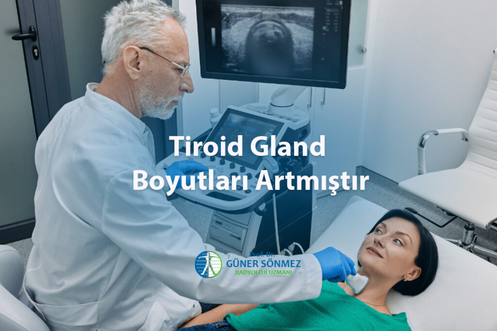 Tiroid Gland Boyutları Artmıştır