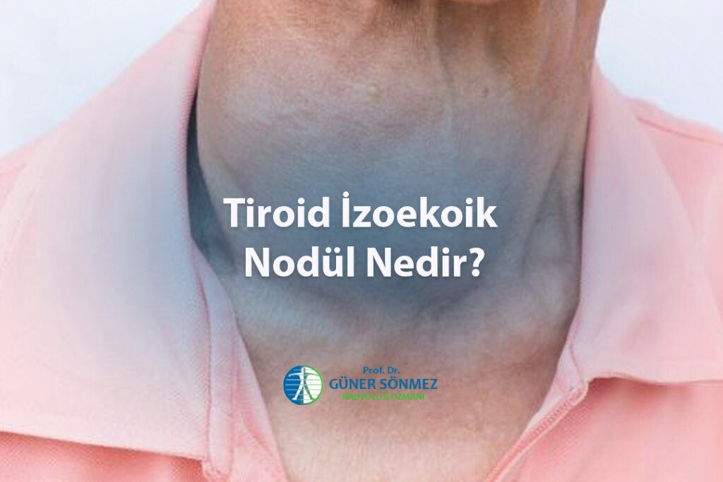 Tiroid İzoekoik Nodül Nedir