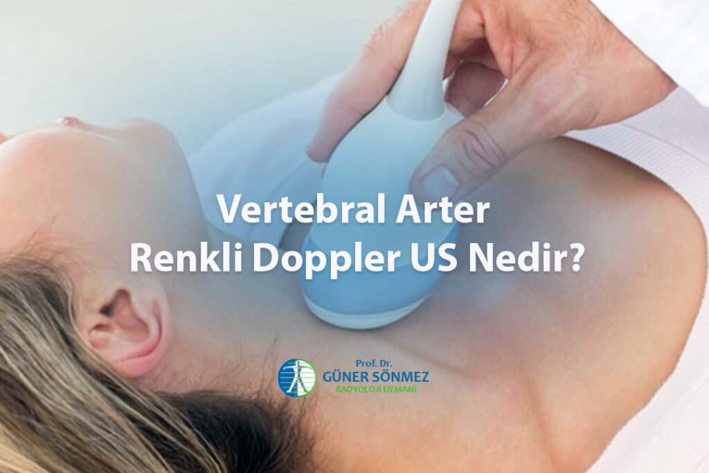 Vertebral Arter Renkli Doppler US Nedir